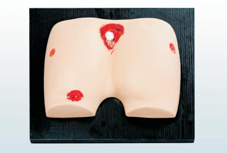 褥瘡護(hù)理仿真模型 褥瘡護(hù)理仿真模型